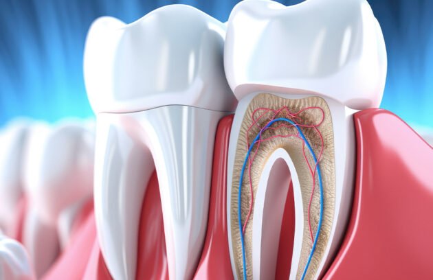 Root Canal Treatment