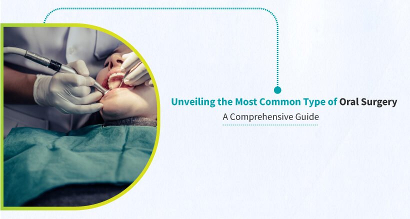 Types of Oral Surgery