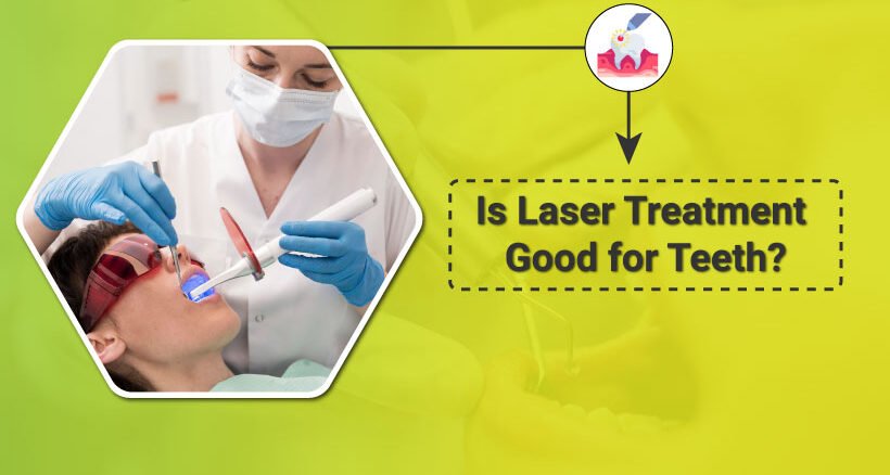 Laser treatment for teeth