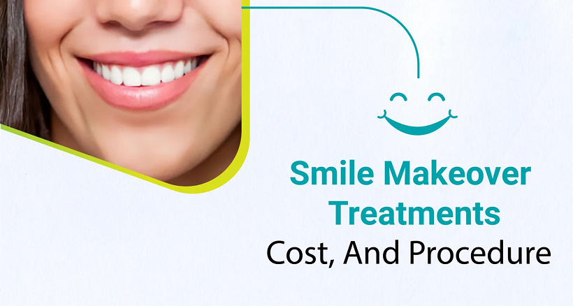 Smile Makeover Treatments Cost