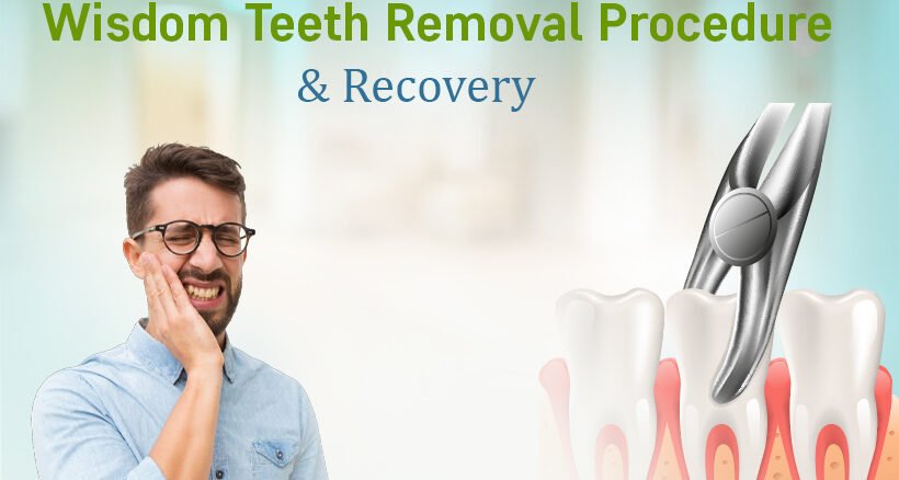 Wisdom Teeth Removal Procedure & Recovery