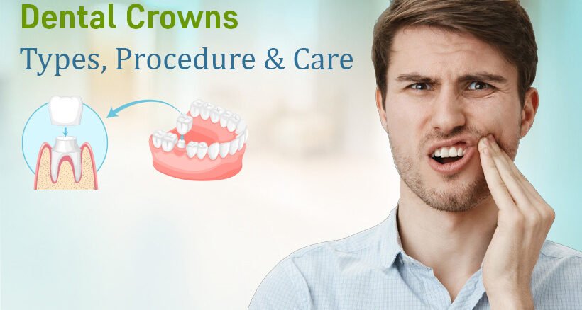 Dental Crowns Specialist in Ahmedabad