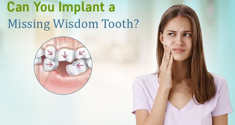 Implanting a Missing Wisdom Tooth