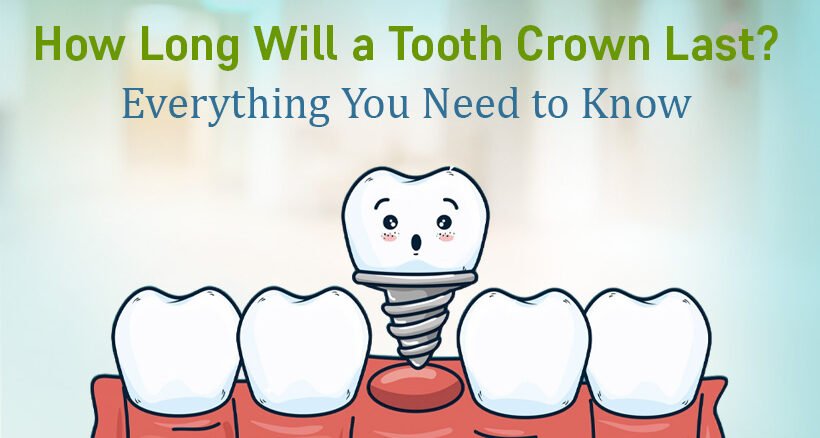 dental crowns clinic in bodakdev