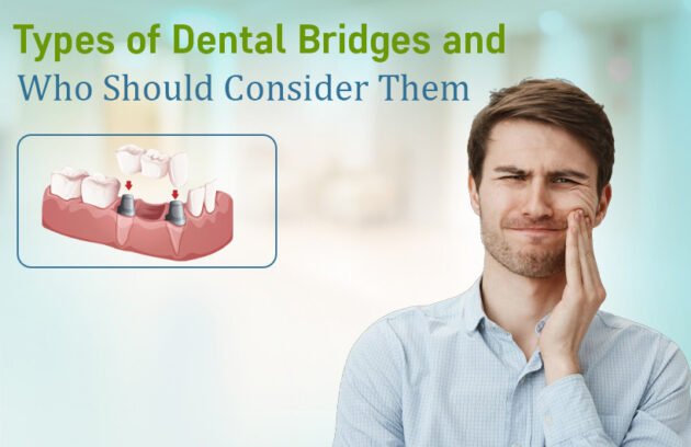 dental bridge specialist in bodakdev