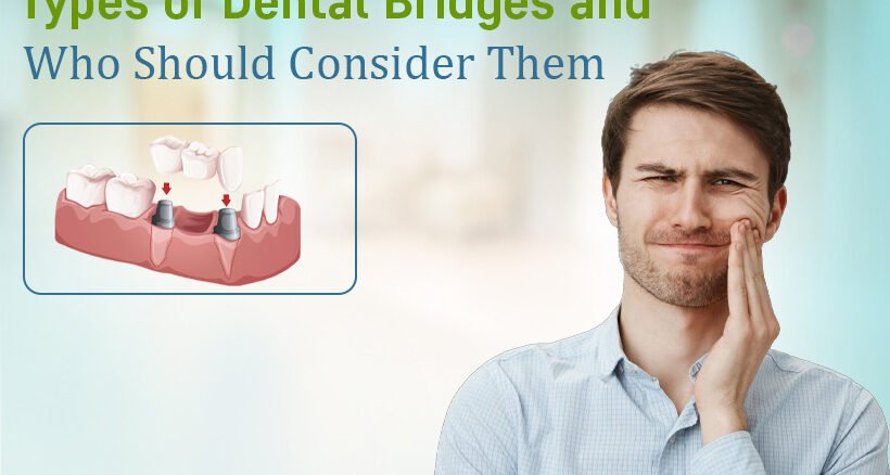 dental bridge specialist in bodakdev