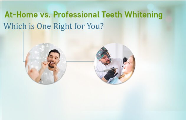 Teeth Whitening Treatment in Ahmedabad