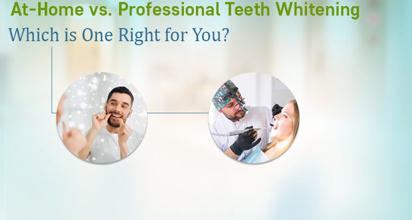 Teeth Whitening Treatment in Ahmedabad