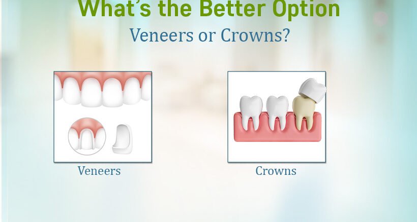 Remove term: Dental Crowns and Veneer Treatment Dental Crowns and Veneer Treatment