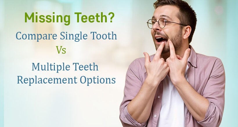 Dental Implants Specialist Ahmedabad