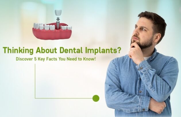 Dental Implants Treatment in Ahmedabad