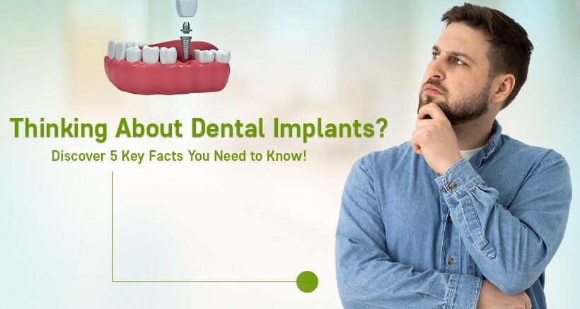 Dental Implants Treatment in Ahmedabad