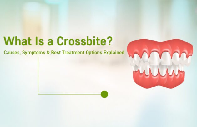 Dental Crossbite Treatment in Ahmedabad
