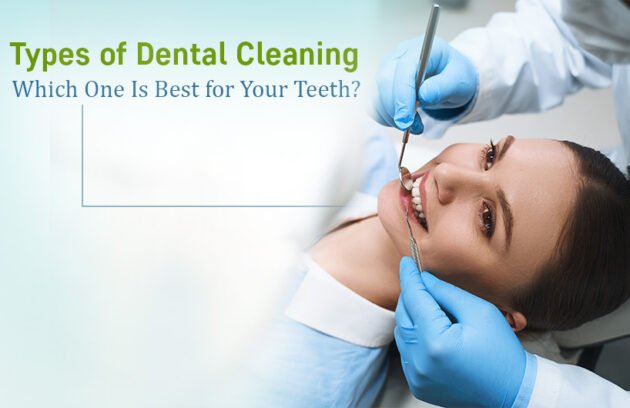 Types of Dental Cleaning