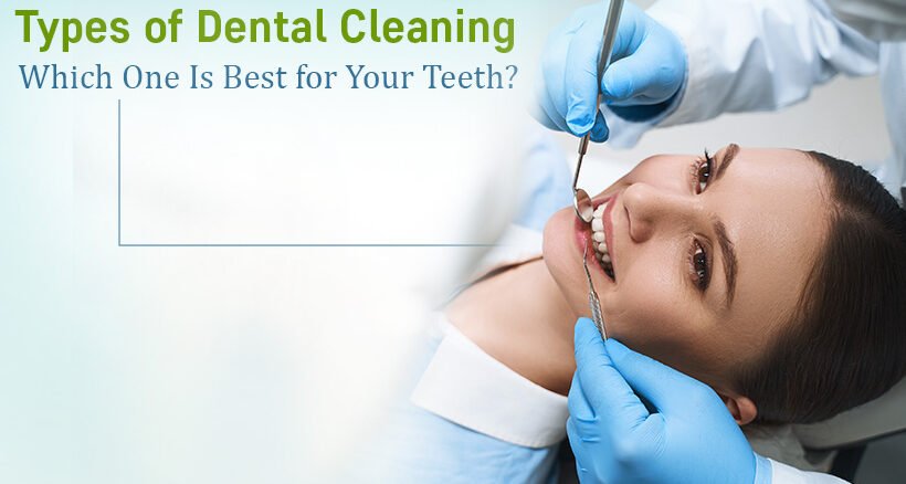 Types of Dental Cleaning