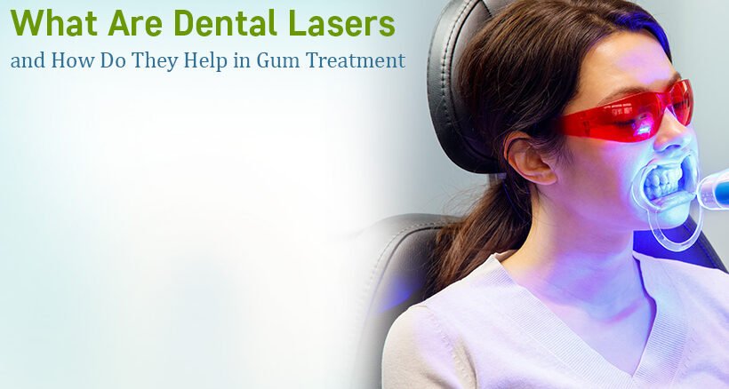 Gum Laser Treatment