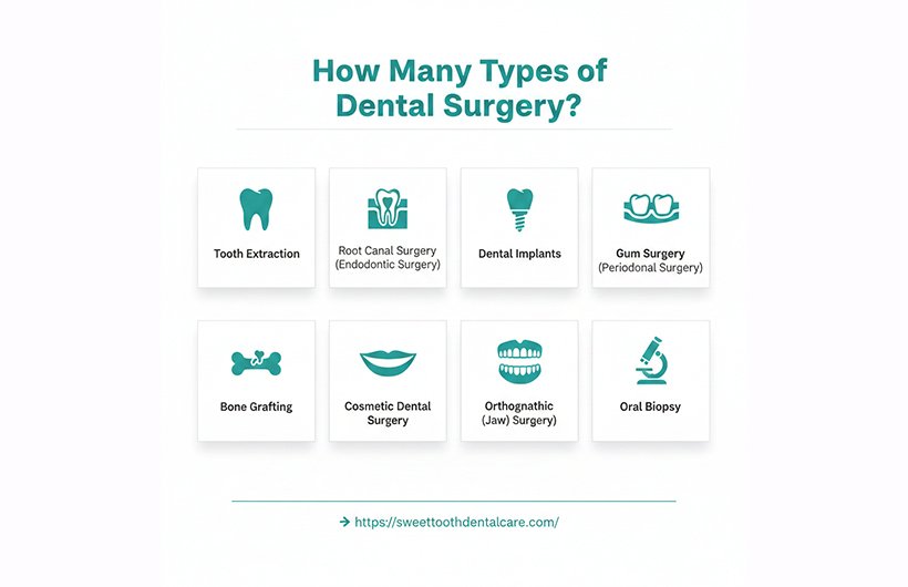 Types of Dental Surgery