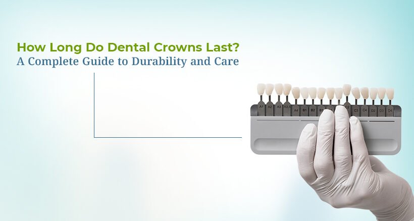 How Long Do Dental Crowns Last