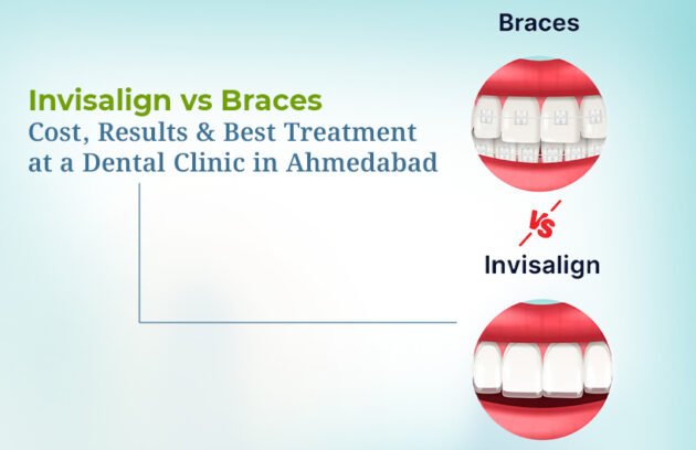 Invisalign vs Braces Treatment