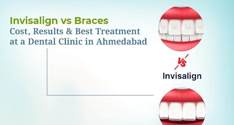 Invisalign vs Braces Treatment