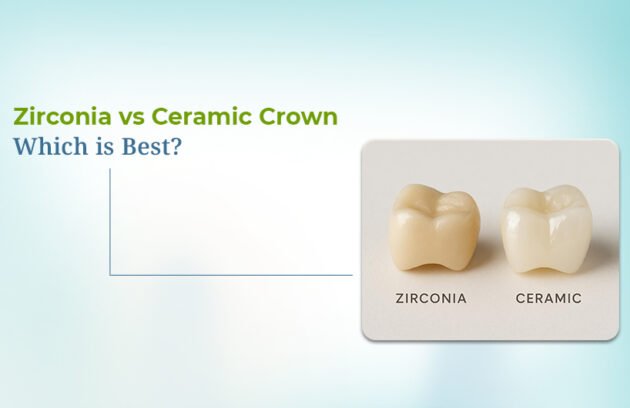 Zirconia vs Ceramic Crown