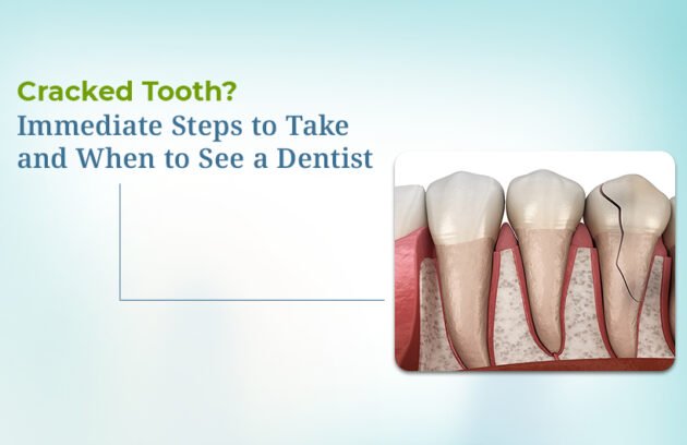 Best Treatment for a Cracked Tooth