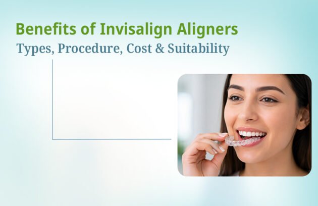Benefits of Invisalign