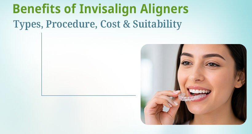 Benefits of Invisalign