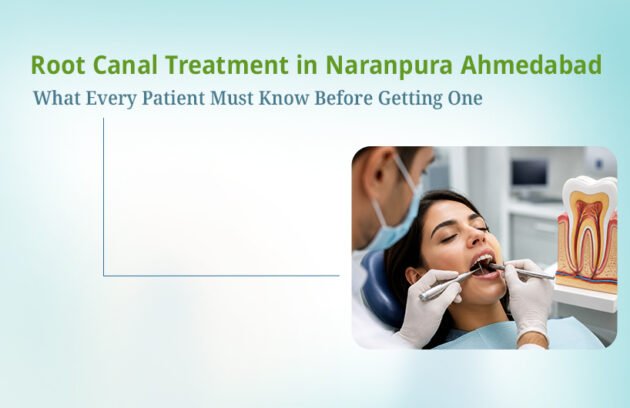 Root Canal Treatment in Ahmedabad