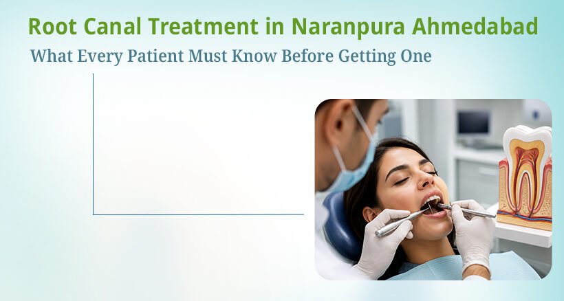 Root Canal Treatment in Ahmedabad