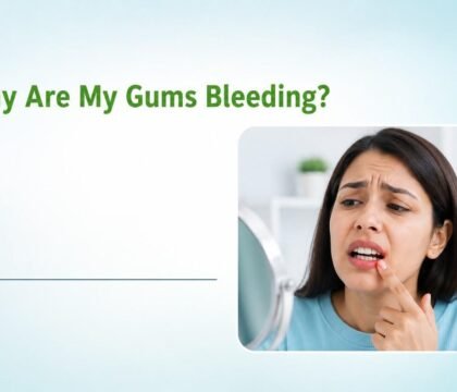 Why Are My Gums Bleeding
