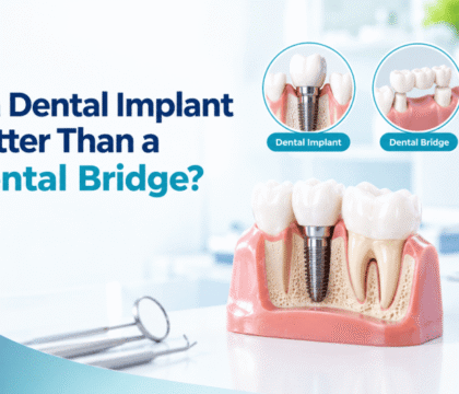 Dental Implant vs. Dental Bridge