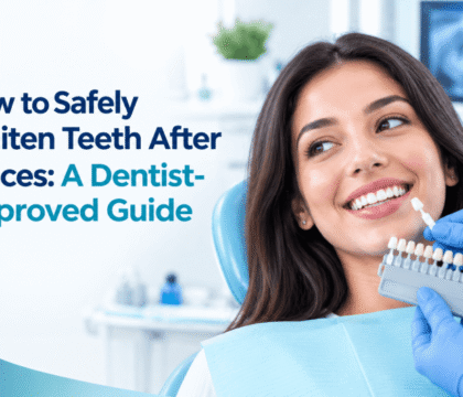 Teeth Whitening After Braces