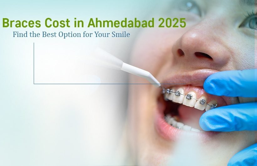 Braces Cost in Ahmedabad 2025 – Find the Best Option for Your Smile