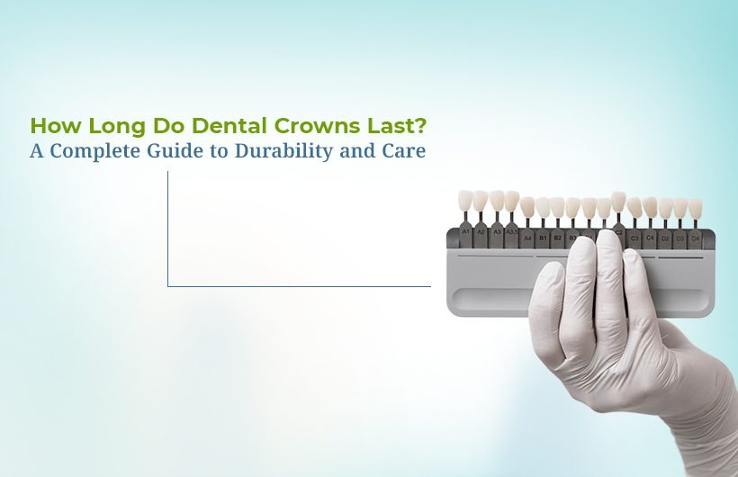 How Long Do Dental Crowns Last