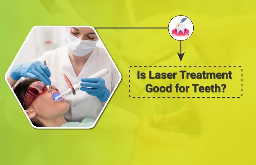 Laser treatment for teeth