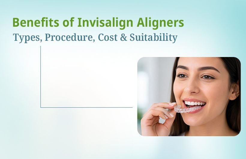 Benefits of Invisalign
