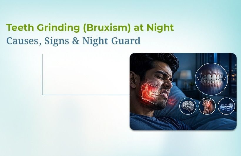 teeth grinding treatment Naranpura Ahmedabad