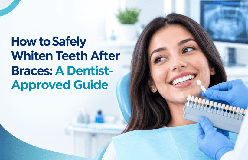 Teeth Whitening After Braces