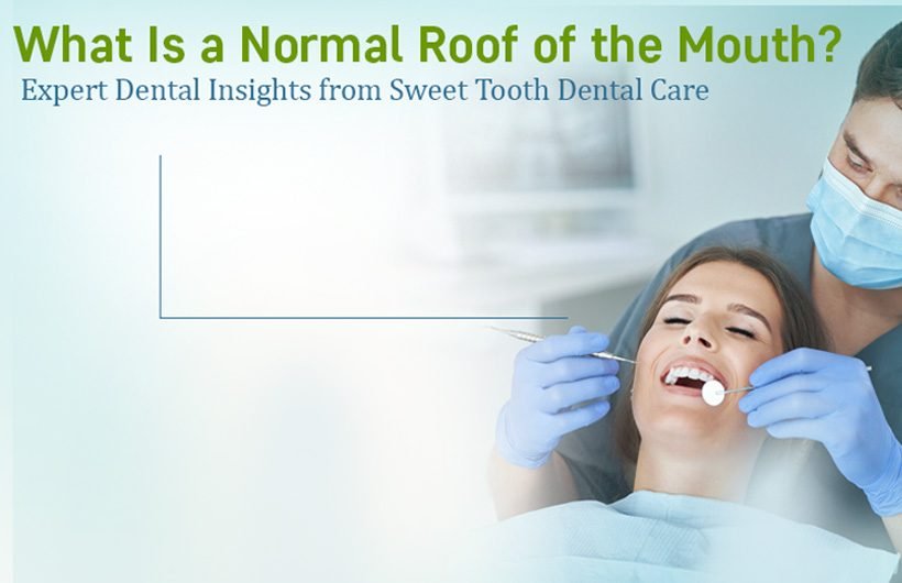 What Is a Normal Roof of the Mouth Expert Dental Insights from Sweet Tooth Dental Care copy Normal Roof of Mouth Dental Expert Guide