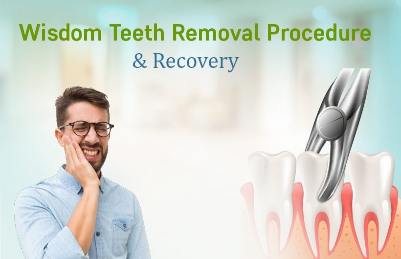 Wisdom Teeth Removal Procedure & Recovery