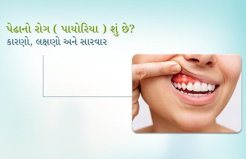 પેઢાનો રોગ (પાયોરિયા) શું છે